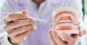 Zirconia Bridge